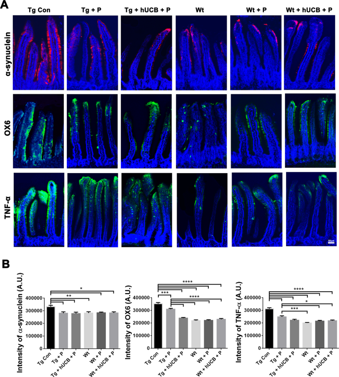 Fig. 4: Intestinal villi inflammation, and α-synuclein load.