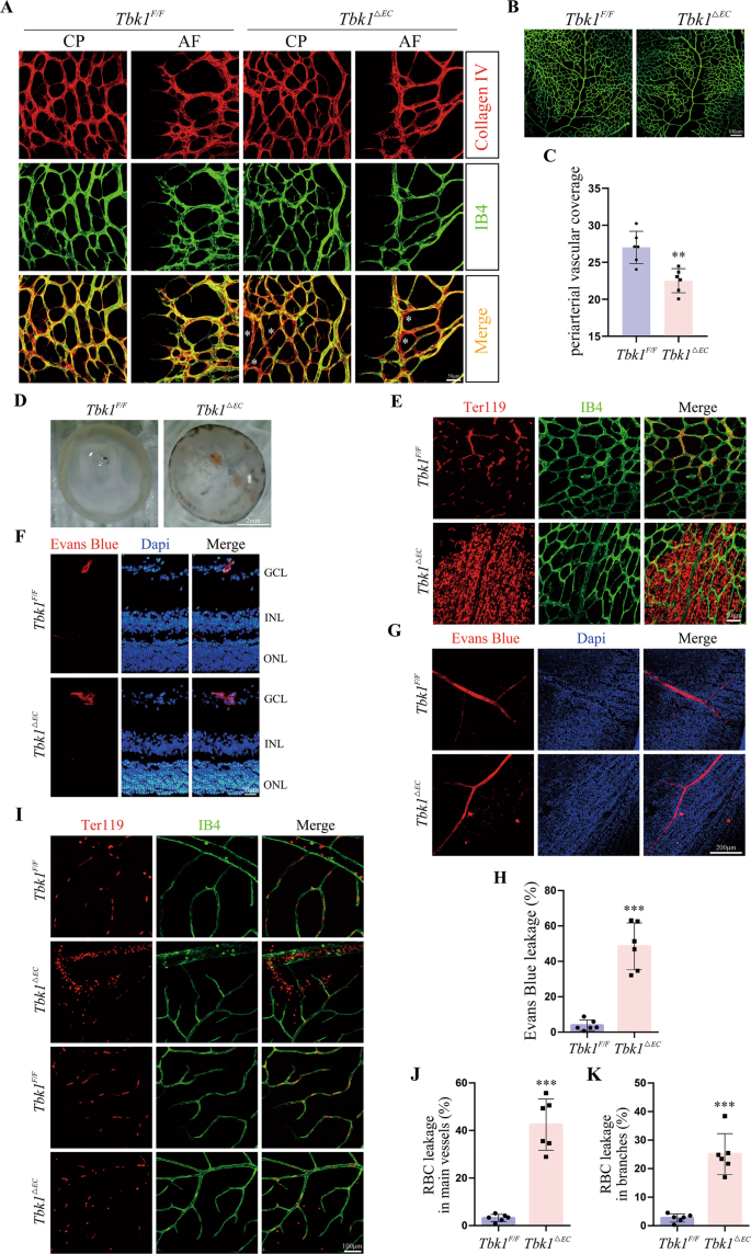Fig. 2: Endothelial TBK1 deprivation impairs BRB.