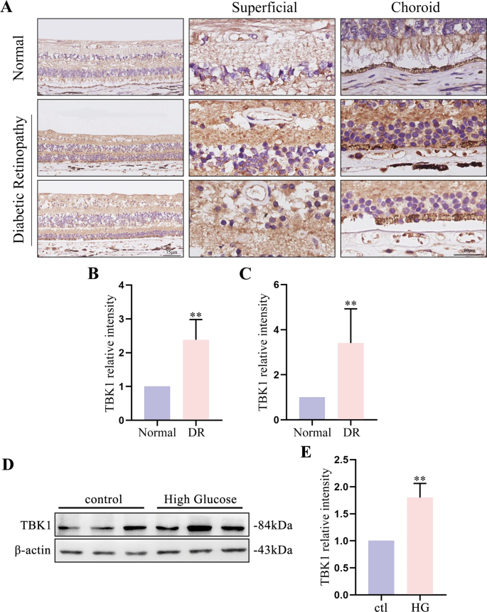Fig. 7: TBK1 expression was increased in human diabetic retinas.