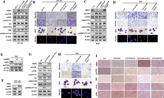 Fig. 7: Enforced expression of SHIP2 rescues the LINC01468 metabolic phenotypes.