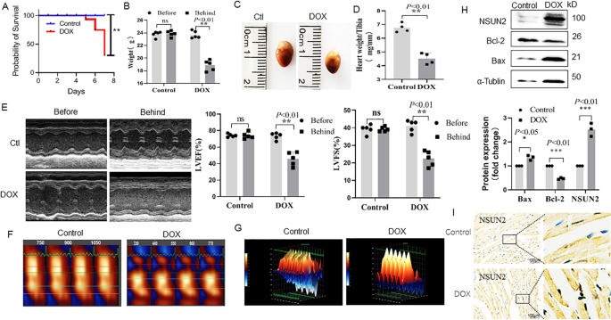 Fig. 1: Effects of DOX treatment on cardiac function and the expression level of NSUN2 in myocardial cells.
