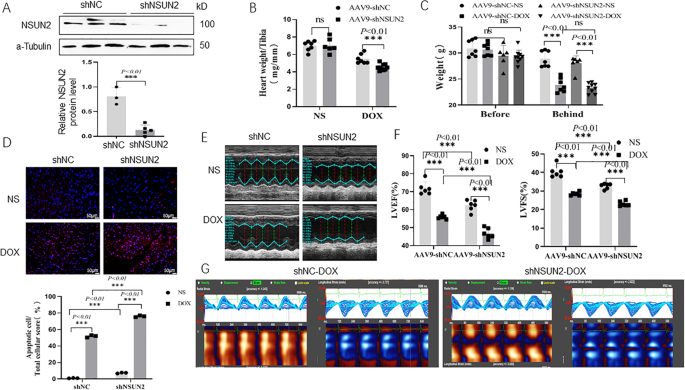Fig. 2: Interfering with NSUN2 expression promoted DOX-induced myocardial injury.