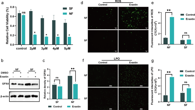 Fig. 2: Senescent fibroblasts exhibit a ferroptosis-resistant phenotype.