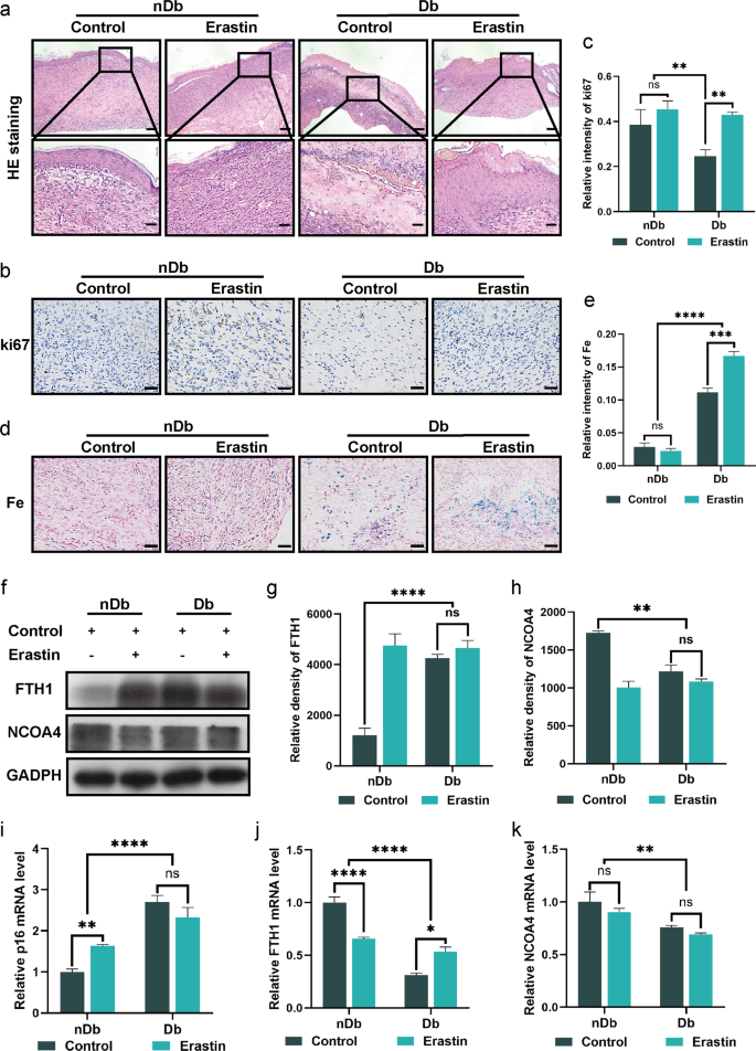 Fig. 6: Erastin accelerate wounds healing process.