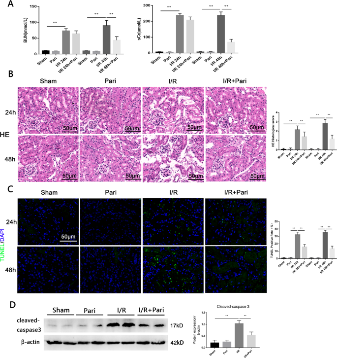 Fig. 1: VDR agonist paricalcitol attenuated I/R-induced renal tissue damage and apoptosis.