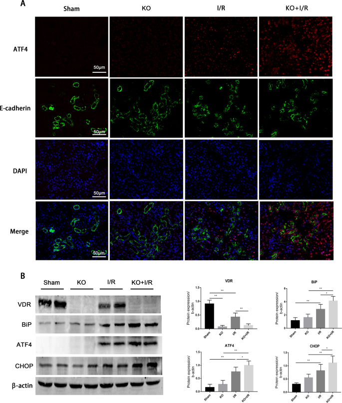Fig. 4: VDR knockout aggravated I/R induced ERS.