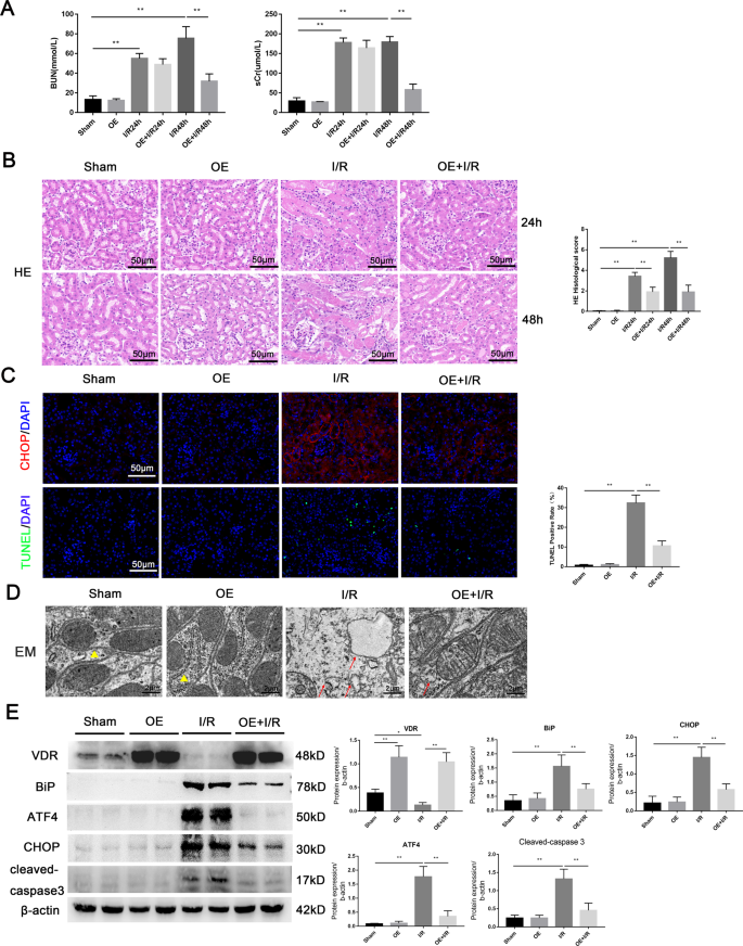 Fig. 5: Overexpression of VDR attenuated I/R-induced renal tissue damage, apoptosis, and ERS.