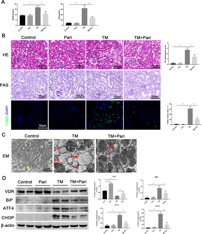 Fig. 6: Paricalcitol attenuated TM-induced renal tissue damage, apoptosis, and ERS.