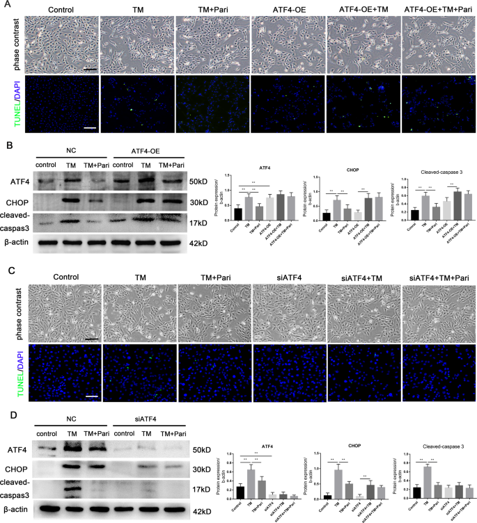Fig. 7: VDR inhibited ERS through the inhibition of ATF4.