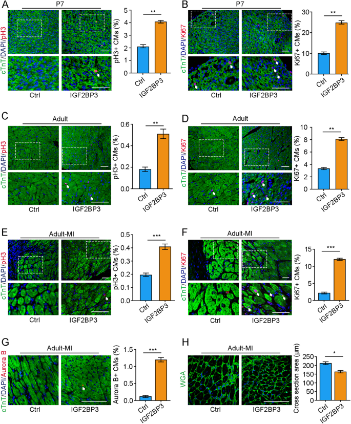 Fig. 3: IGF2BP3 promotes cardiac regeneration in adult mice after MI.
