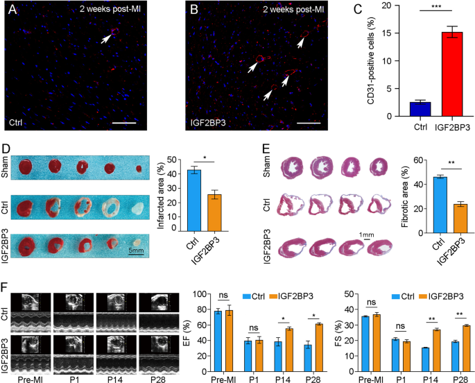 Fig. 4: IGF2BP3 promotes myocardial regeneration and improves cardiac function after MI in adult mice.