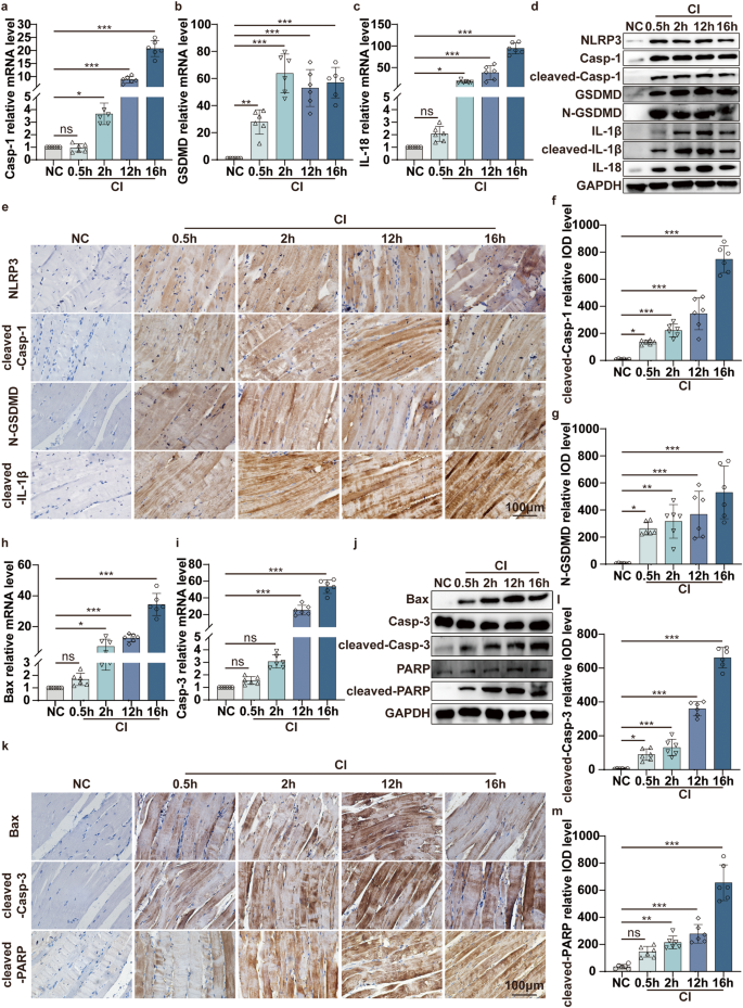 Fig. 1: Pyroptosis and apoptosis both occur in the skeletal muscle of the mouse CI model.