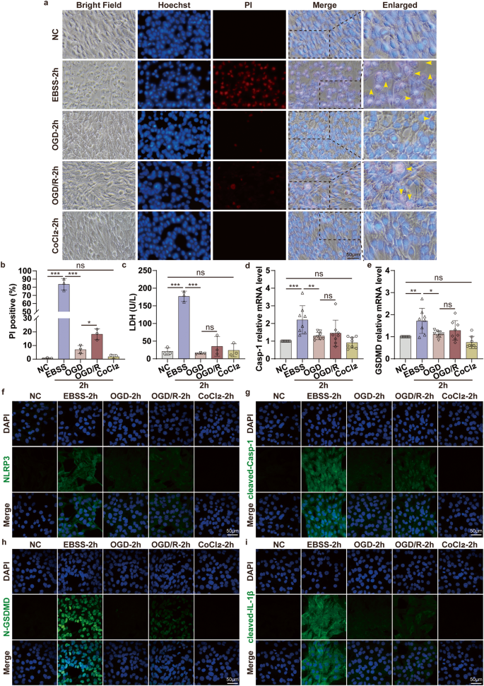 Fig. 3: OGD ischemia and hypoxia model significantly alleviate the ischemic-induced cell pyroptosis via NLRP3/Casp-1/GSDMD pathway in vitro.