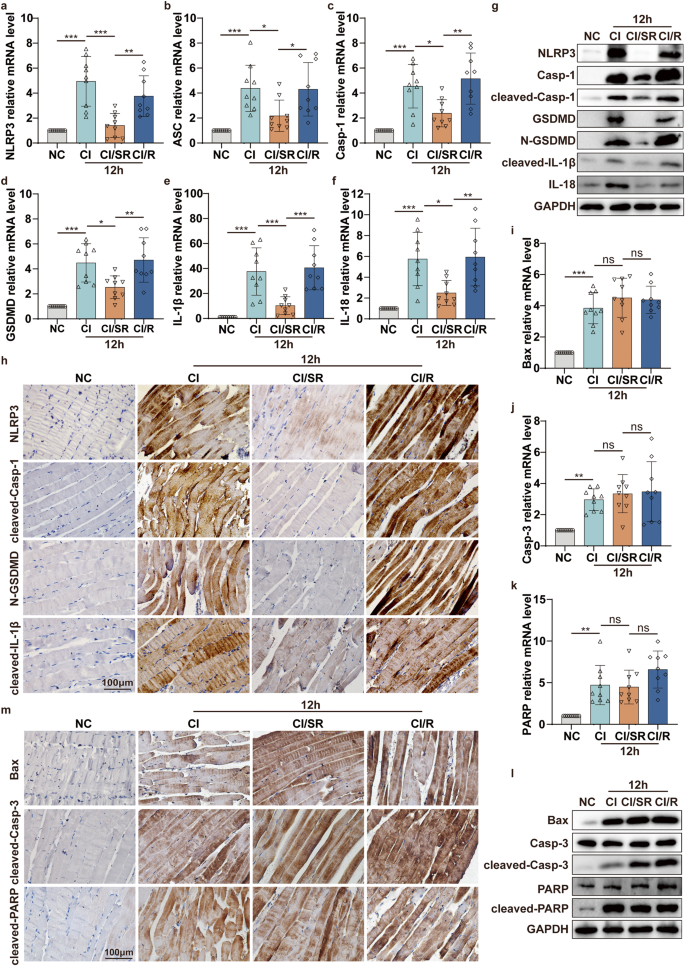 Fig. 6: Delayed step-by-step decompression significantly alleviates cell pyroptosis in skeletal muscle of CI mediated by NLRP3/Casp-1/GSDMD pathway.