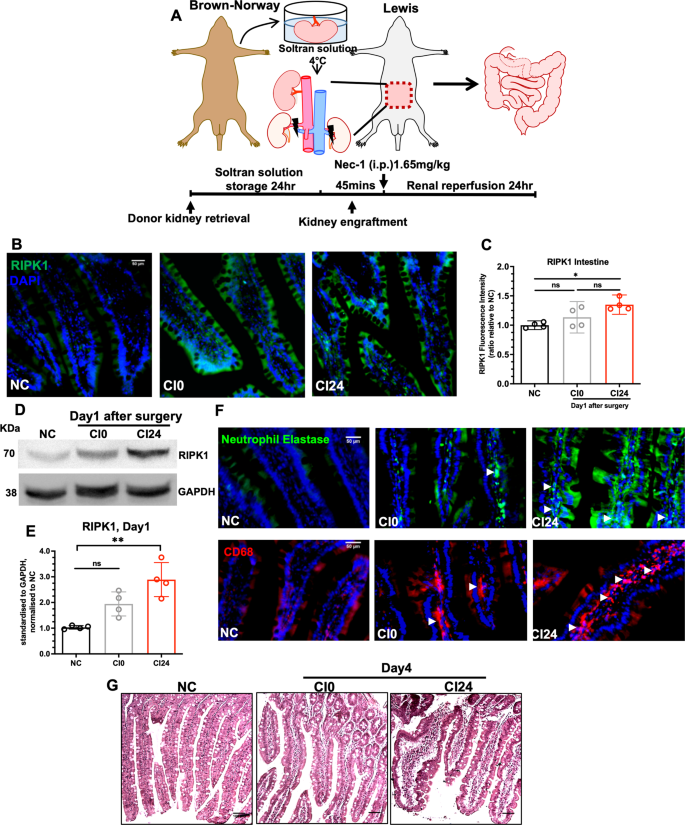 Fig. 1: Ischaemic kidney transplantation is associated with remote small intestinal injury.