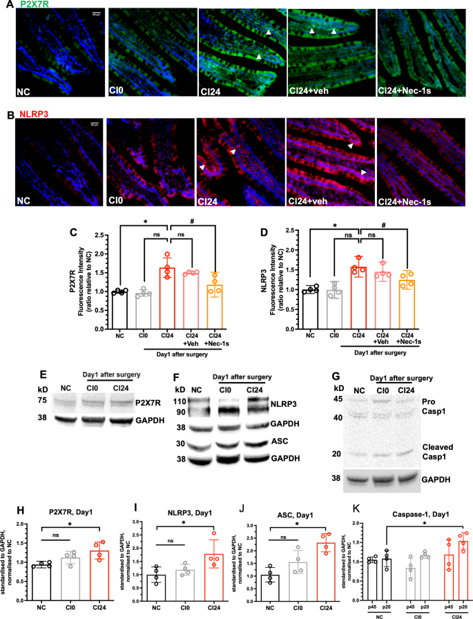 Fig. 2: Ischaemic kidney transplantation leads to inflammasome activation in small intestine.