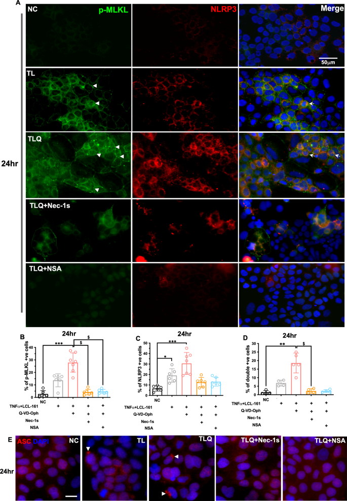 Fig. 6: Necroptosis is associated with inflammasome activation in Caco-2 cells.