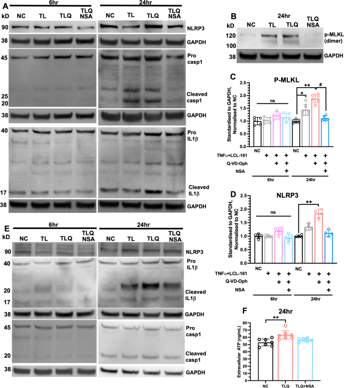 Fig. 7: Inhibition of necroptosis prevents inflammasome activation in vitro.