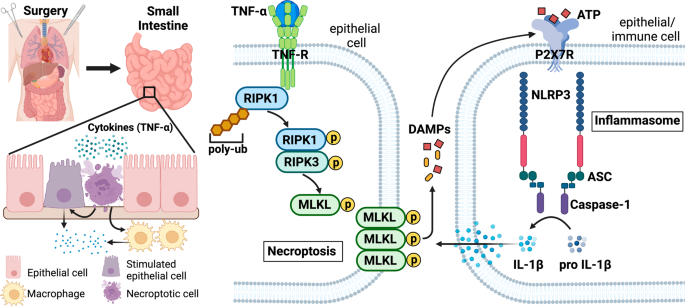 Fig. 8: Putative mechanisms underlying postoperative small intestinal injury.