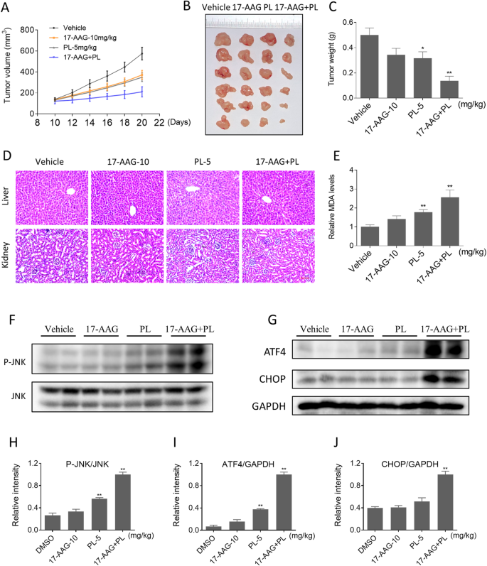 Fig. 8: PL and 17-AAG synergize to inhibit the growth of colon cancer cells in vivo.