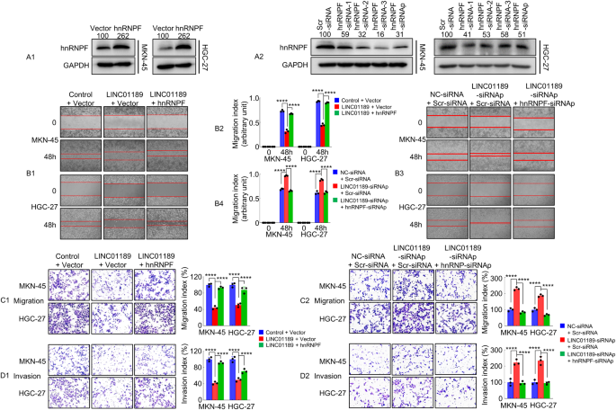 Fig. 6: LINC01189 modulates hnRNPF-mediated GC invasion and metastasis in vitro.