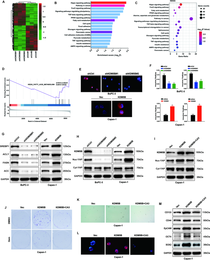 Fig. 4: KDM5B enhance de novo lipogenesis in PDAC.
