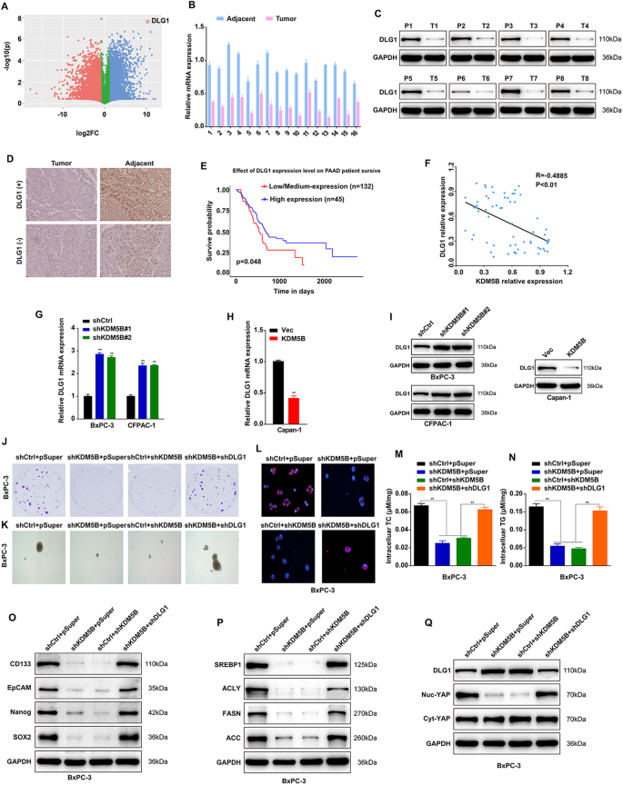 Fig. 5: DLG1 is a mediator for KDM5B-induced malignant phenotype in PDAC cells via Hippo pathway.