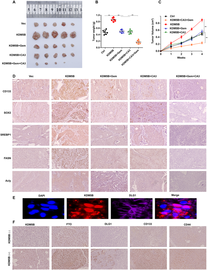 Fig. 6: KDM5B as a potential therapeutic target for PDAC progression and resistance.