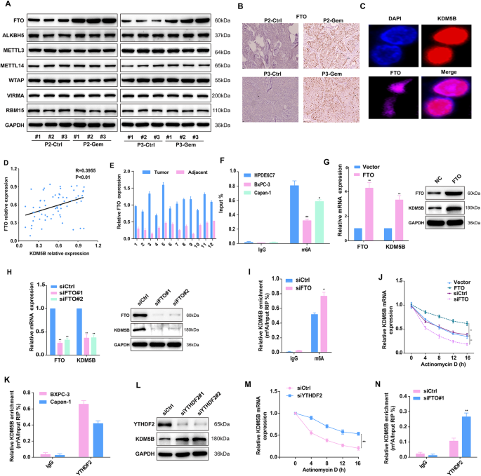 Fig. 7: m6A modification induced by FTO upregulates KDM5B.