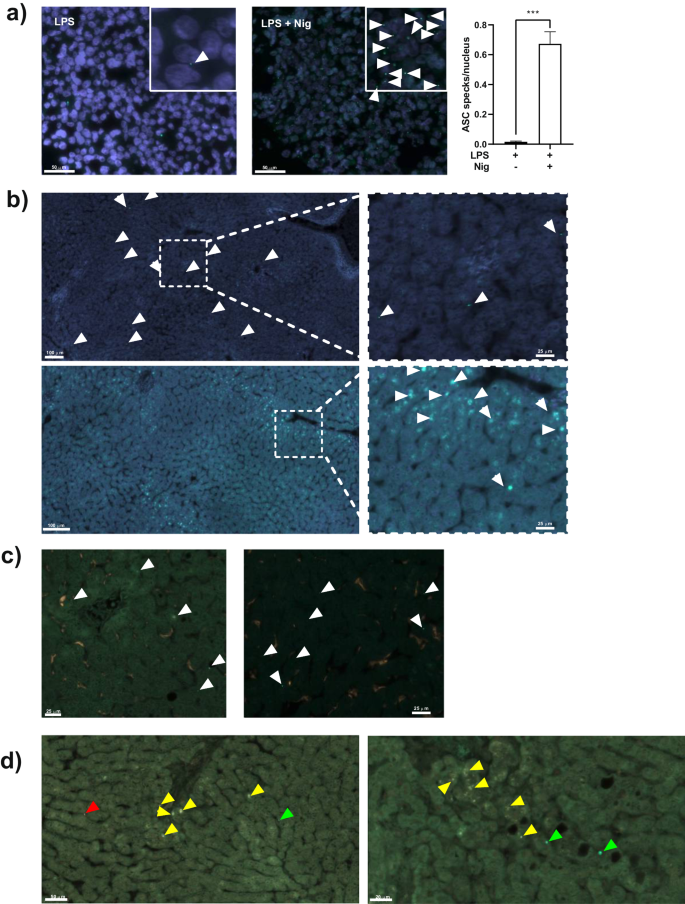 Fig. 2: Detection of ASC specks in fixed tissue from donated livers.