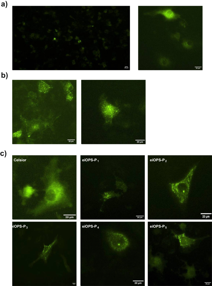 Fig. 4: Organ preservation solution collected after cold ischemic storage activates the NLRP3 inflammasome in hepatocytes.