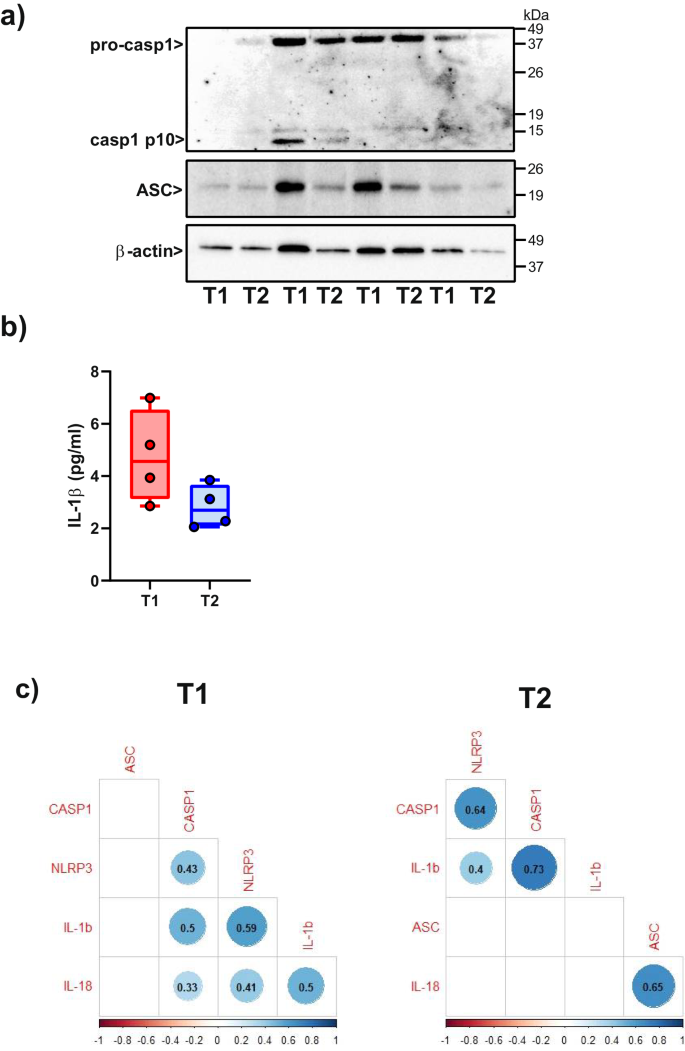Fig. 6: Detection of ASC, caspase-1 and IL-1β in liver biopsies at the protein level.