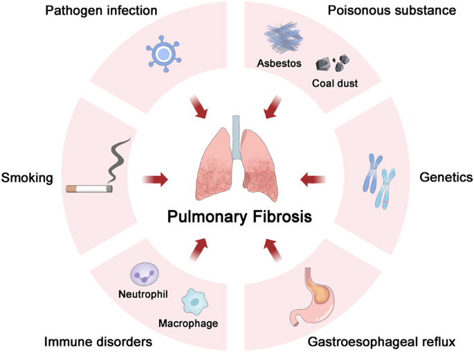 Fig. 1: Risk factors of PF.
