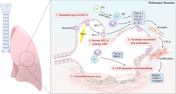 Fig. 2: Molecular insights into PF pathophysiology.