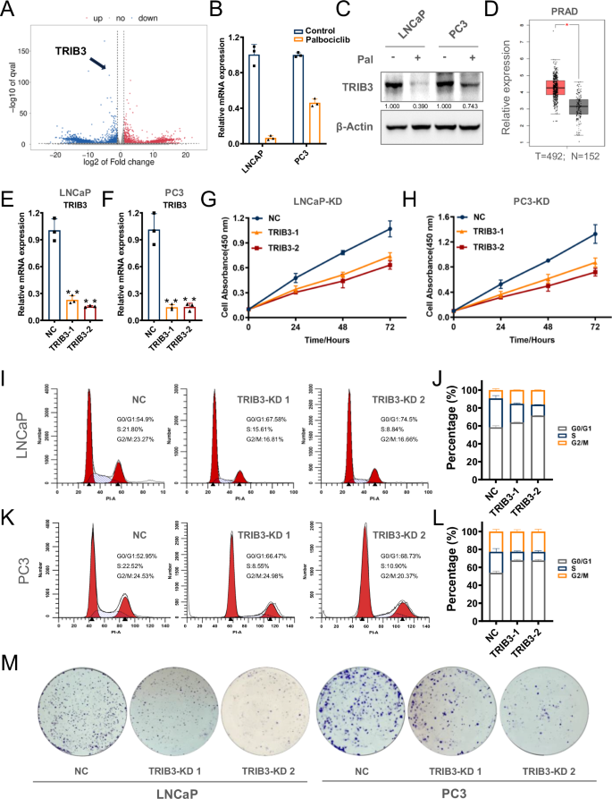 Fig. 2: Palbociclib-induced TRIB3 inhibition is involved in the progression of cell cycle arrest.
