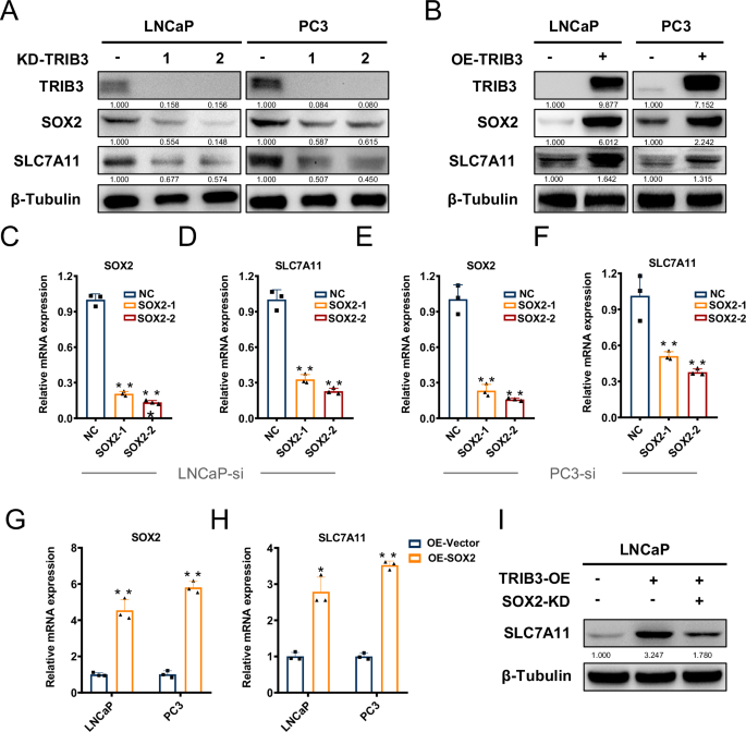 Fig. 6: TRIB3 increases SLC7A11 transcription via SOX2 expression enhancement.