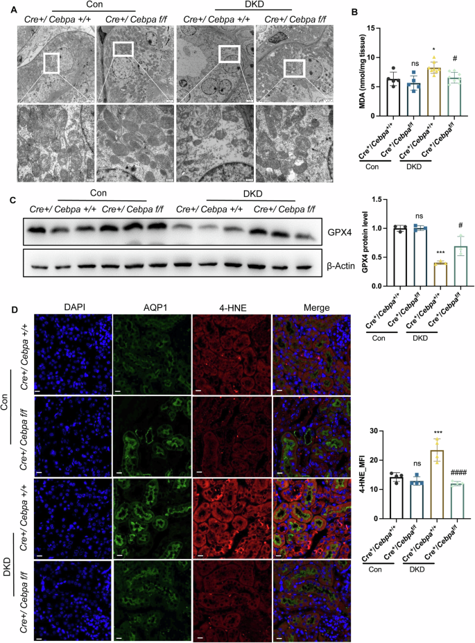 Fig. 3: C/EBPα induced tubular injury through ferroptosis.