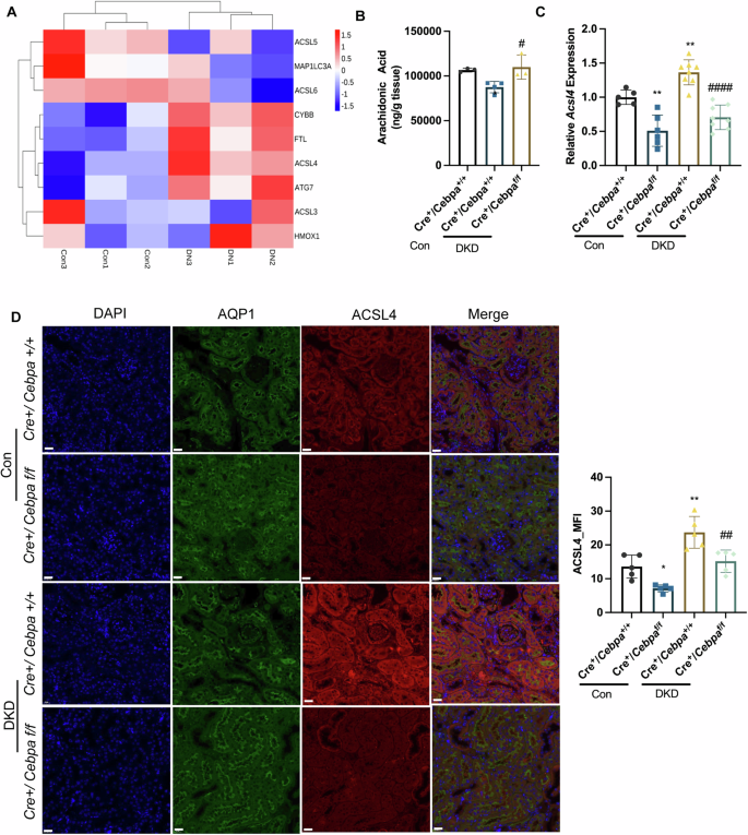 Fig. 4: C/EBPα deficiency alleviated ferroptosis in DKD by downregulating ACSL4.
