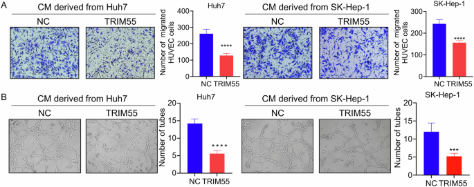 Fig. 3: TRIM55 inhibits HCC angiogenesis.