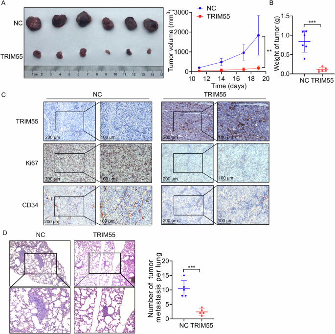 Fig. 4: TRIM55 inhibits HCC progression in vivo.