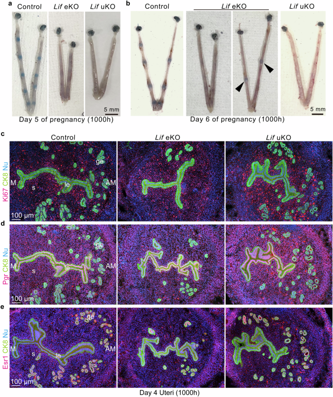 Fig. 2: Embryo attachment, but not uterine receptivity, is impaired upon Lif deletion.