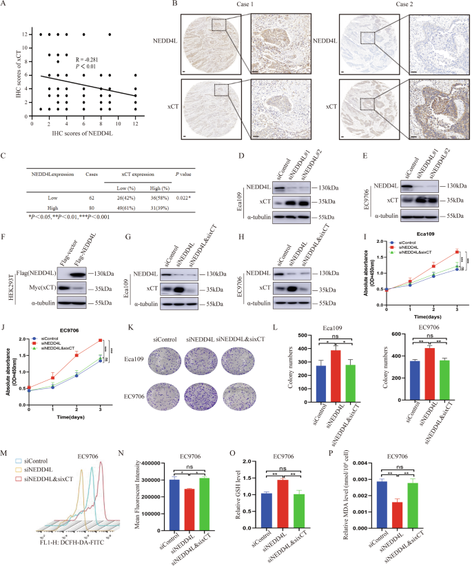 Fig. 4: NEDD4L expression reversely relates with xCT level in ESCC.