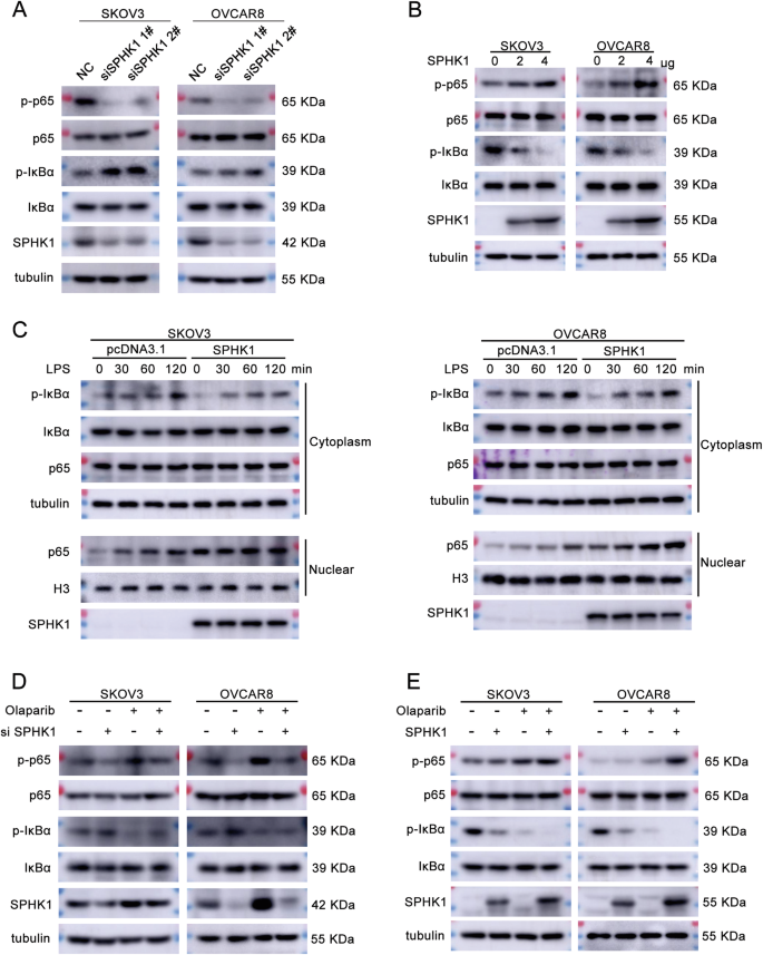 Fig. 4: SPHK1 activates the NF-κB signaling pathway.