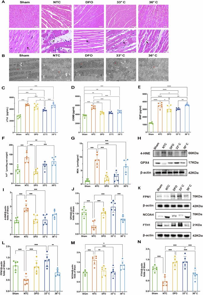 Fig. 2: Histological and biochemical analysis of myocardial tissues post-resuscitation in different treatment groups.