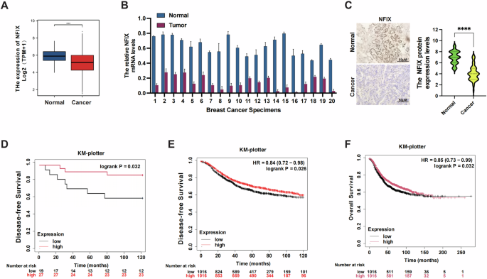 Fig. 1: High NFIX expression predicts favorable outcomes in patients with breast cancer.