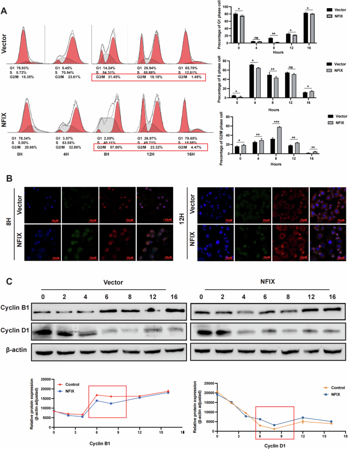 Fig. 4: NFIX-overexpressing breast cancer cells displayed mitotic defects.