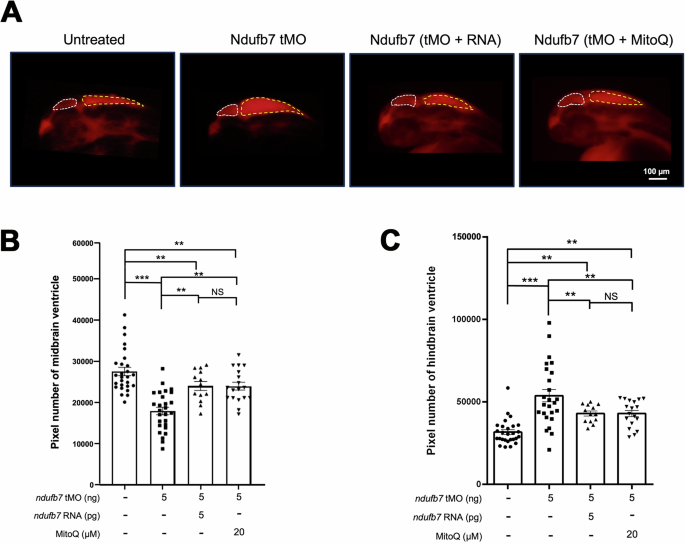 Fig. 4: Knockdown of Ndufb7 changes the sizes of brain ventricles revealed by dextran rhodamine injection.