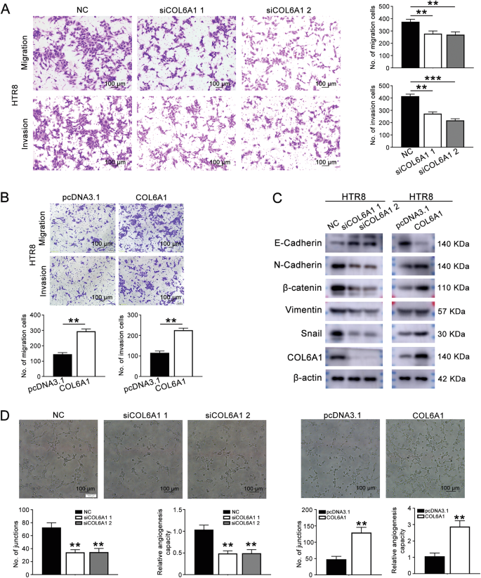 Fig. 2: COL6A1 promoted the migration, invasion, and endothelial-like tube formation of HTR8/SVneo cells.