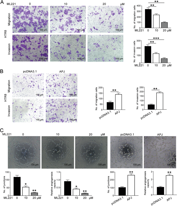 Fig. 5: APJ promoted the migration, invasion, and endothelial-like tube formation of HTR8/SVneo cells.