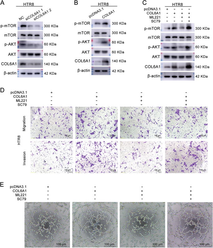 Fig. 6: COL6A1 promoted the migration, invasion, and endothelial-like tube formation of HTR8/SVneo cells through APJ/AKT/mTOR pathway.